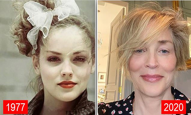 Sharon-Stone-Before-and-After-Cosmetic-Surgery