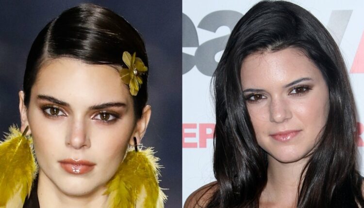 Kendall Jenner before and after