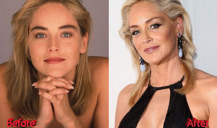 Sharon Stone