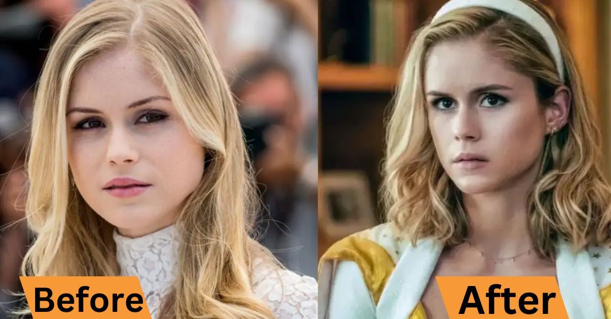 Erin Moriarty Plastic Surgery