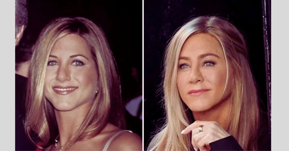 Jennifer Aniston Plastic Surgery