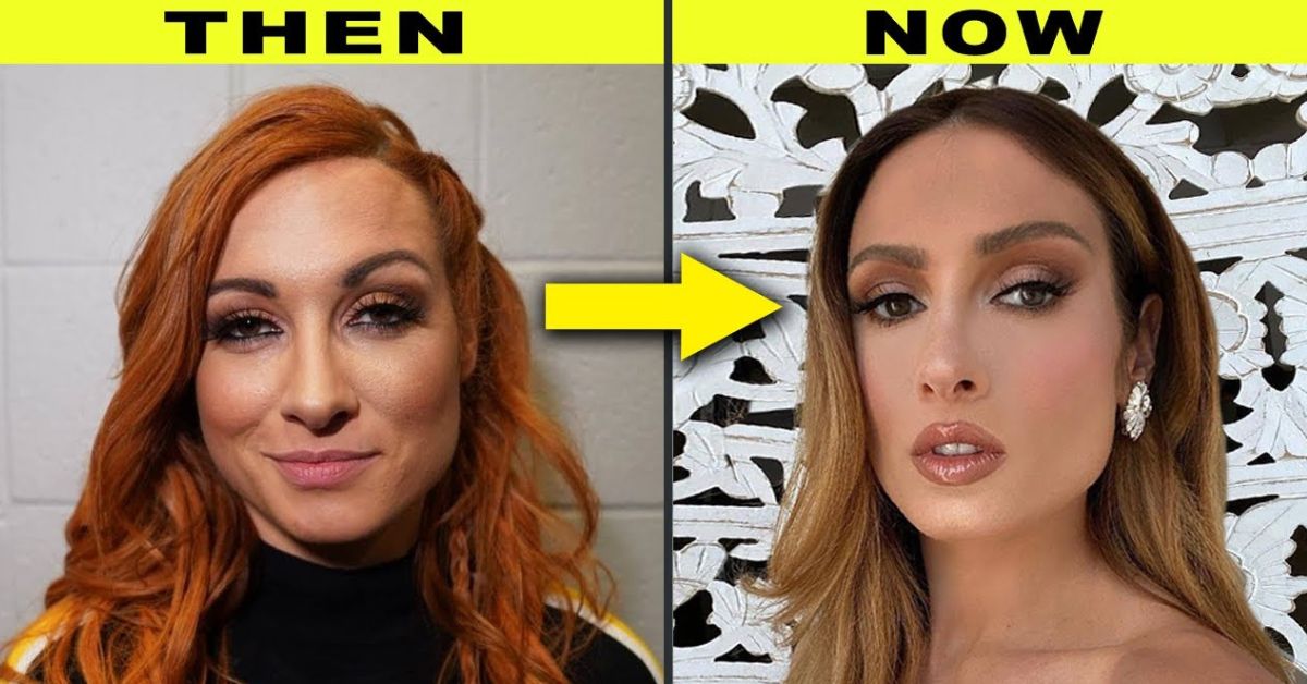 Becky Lynch Plastic Surgery