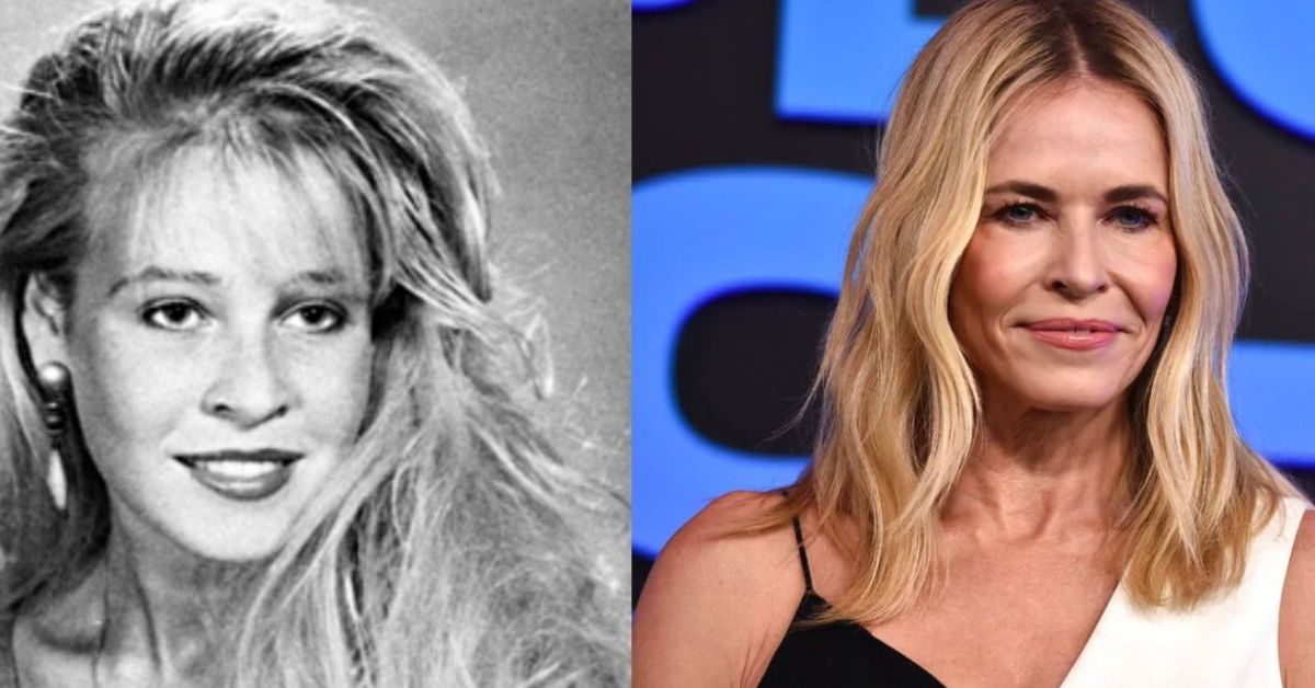 Chelsea Handler Plastic Surgery