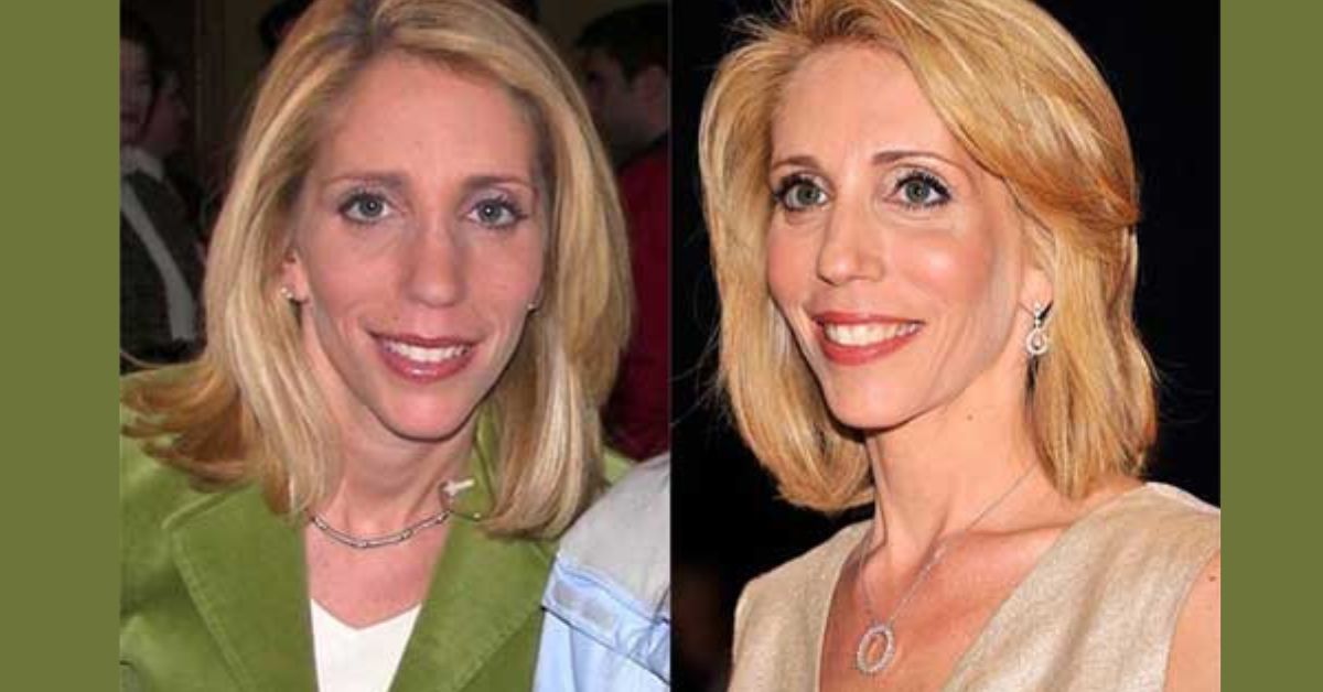 Dana Bash Plastic Surgery