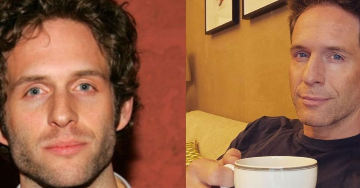 Glenn Howerton Plastic Surgery