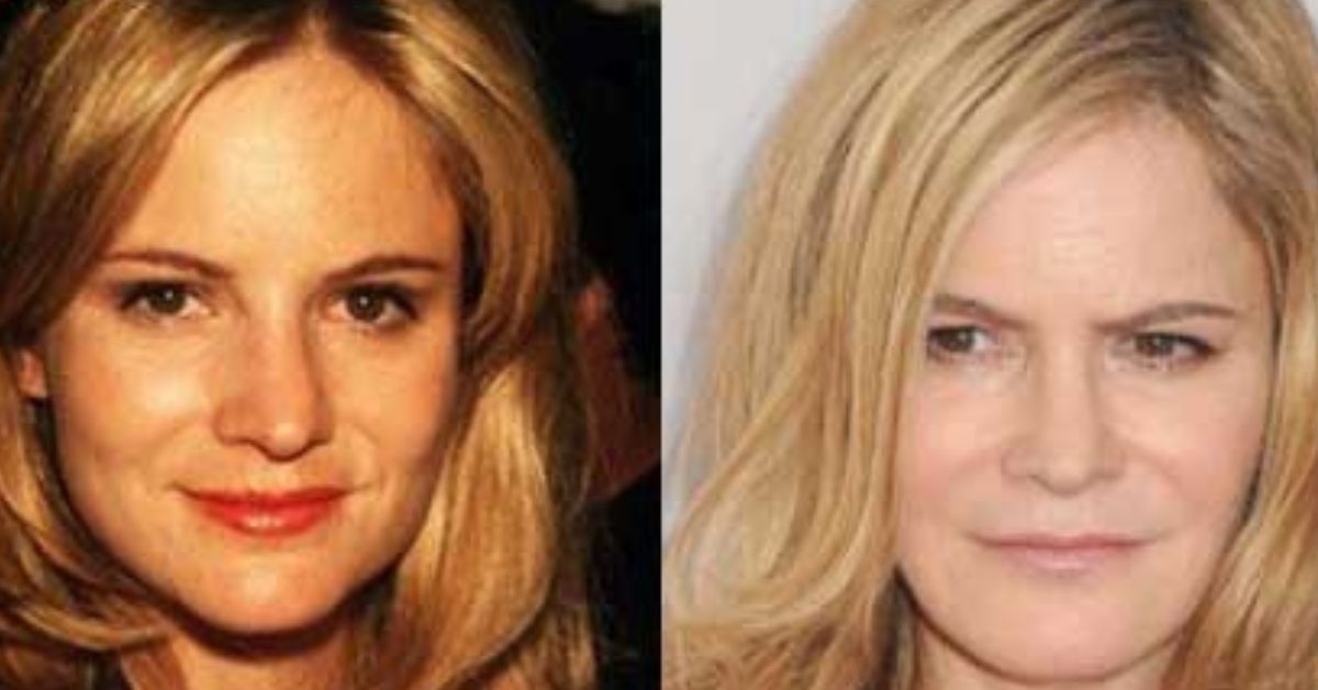 Jennifer Jason Leigh Plastic Surgery