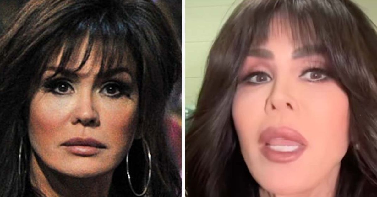 Marie Osmond Plastic Surgery