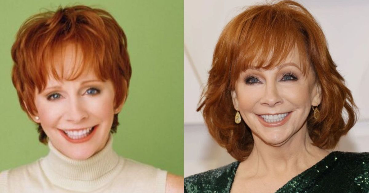 Reba McEntire Plastic Surgery