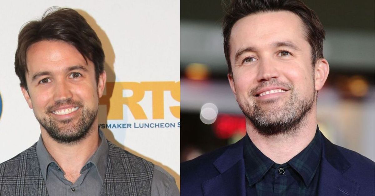 Rob McElhenney Plastic Surgery