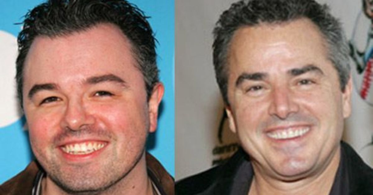 Seth MacFarlane Plastic Surgery Rumors